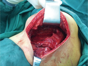 Click on image to zoom