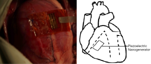 Click on image to zoom