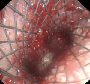 Click on image to zoom