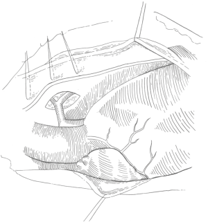 Click on image to zoom