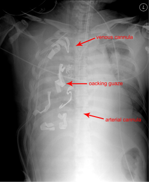 Click on image to zoom