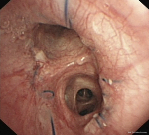 Click on image to zoom