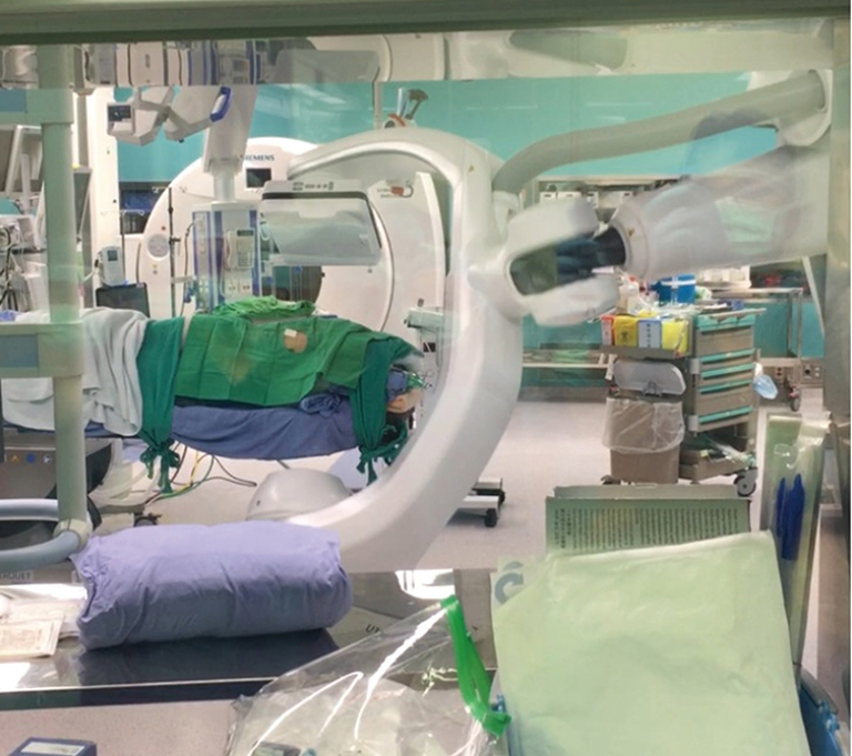Image Guided Video Assisted Thoracoscopic Surgery With Artis Pheno For Pulmonary Nodule Resection Cheng Journal Of Thoracic Disease