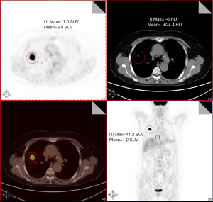 Click on image to zoom