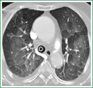 Click on image to zoom Figure 2