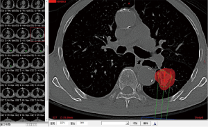 Click on image to zoom