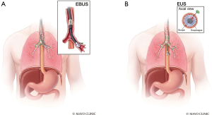 Click on image to zoom