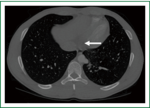 Click on image to zoom Figure 1