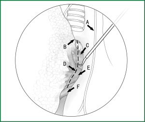 Click on image to zoom Figure 22