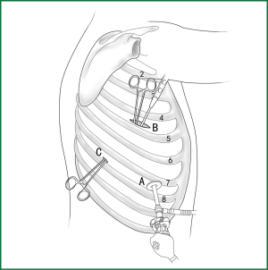 Figure 23