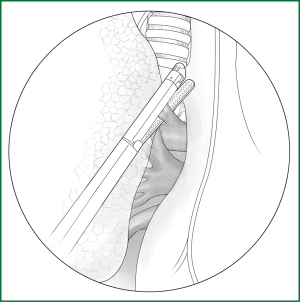 Click on image to zoom Figure 25