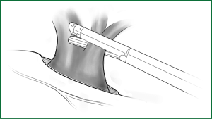 Click on image to zoom Figure 51
