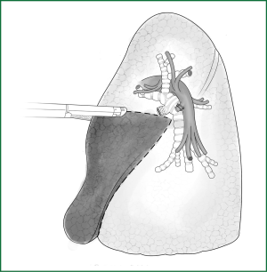 Click on image to zoom Figure 53