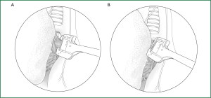 Click on image to zoom Figure 58
