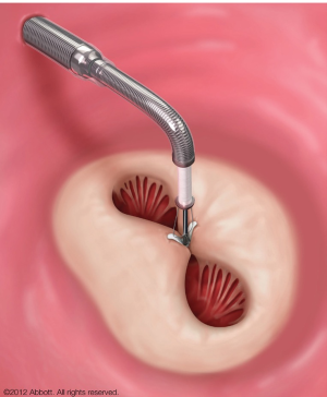 Click on image to zoom