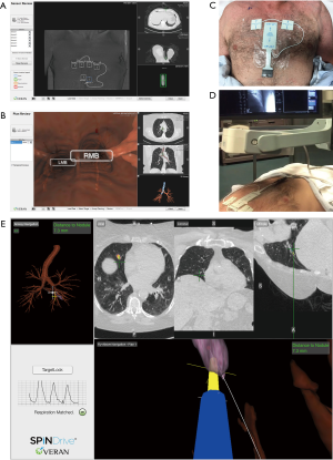 Click on image to zoom