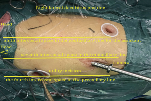 Click on image to zoom