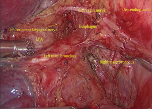 Click on image to zoom