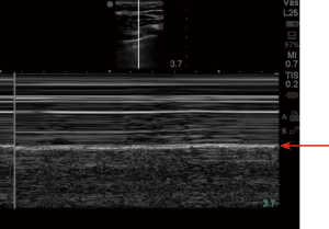 Click on image to zoom