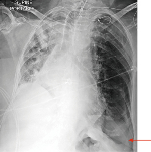 Click on image to zoom