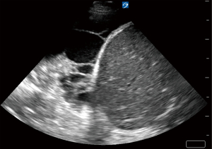 Click on image to zoom