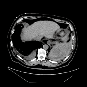 Click on image to zoom