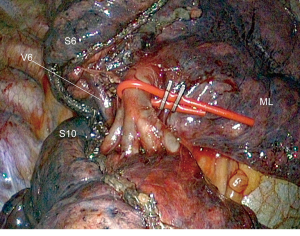 Click on image to zoom