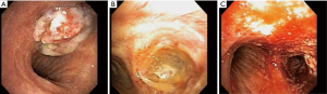 Click on image to zoom