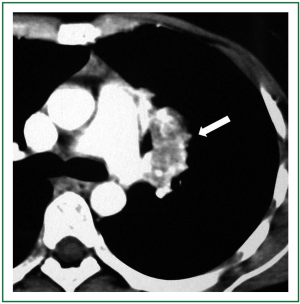 Click on image to zoom Figure 2
