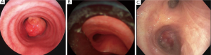 Click on image to zoom