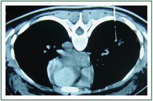 Click on image to zoom Figure 2
