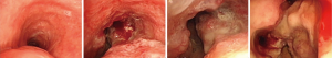 Click on image to zoom
