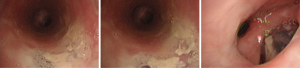 Click on image to zoom