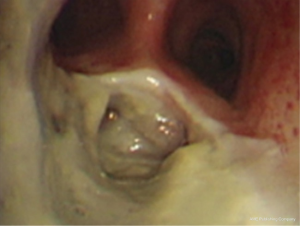 Click on image to zoom