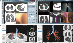 Click on image to zoom