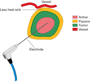 Click on image to zoom