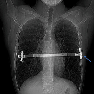 Click on image to zoom