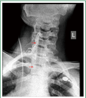 Click on image to zoom