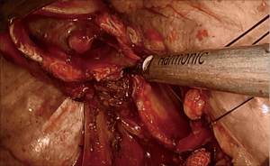 Click on image to zoom
