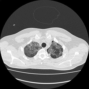 Click on image to zoom