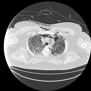 Click on image to zoom