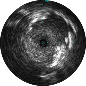 Click on image to zoom