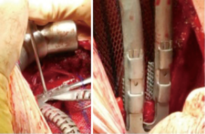 Click on image to zoom