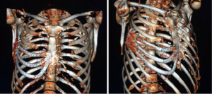 Click on image to zoom