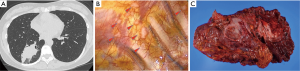Click on image to zoom