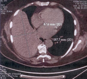 Click on image to zoom