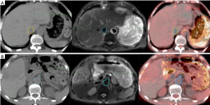 Click on image to zoom