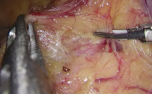 Click on image to zoom