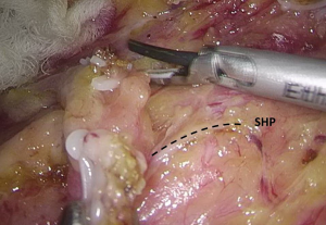 Click on image to zoom