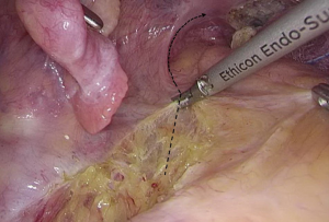 Click on image to zoom